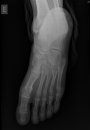 Exemple de radiografia en format digital