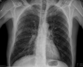 Exemple de radiografia en format digital